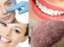 İstanbul'da Diş Kliniği - Dental Clinic in İstanbul Nerede Bulunur?