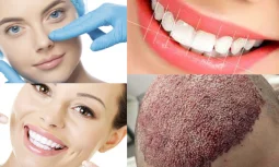 Dental Clinic in Istanbul: Where to Find One?