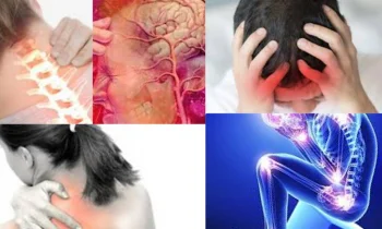 Migren Nedir, Belirtileri Nelerdir