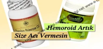 Hemoroid Artık Size Acı Vermesin