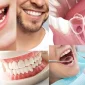 What is Aesthetic Dental Filling?
