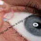 Lensle Havuza Ya Da Denize Girilir Mi?